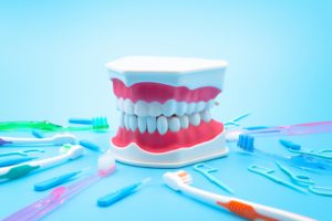 All-onインプラントにかかる費用