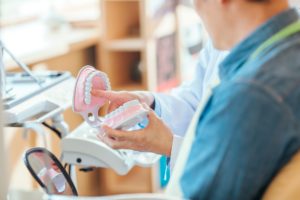 奥歯をインプラントにするタイミング