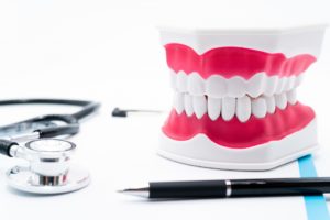 インプラントの医療費控除の申告方法